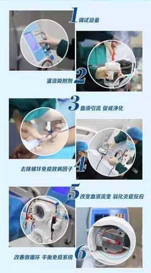 免疫吸附疗法三大优势.jpg 免疫吸附疗法三大优势.jpg