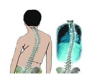 ǿֱ֢״ʲôرǿֱݱʲôģ